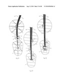 LOW PROFILE ELECTRODE ASSEMBLY diagram and image