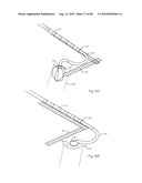 LOW PROFILE ELECTRODE ASSEMBLY diagram and image