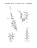 LOW PROFILE ELECTRODE ASSEMBLY diagram and image