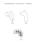 LOW PROFILE ELECTRODE ASSEMBLY diagram and image