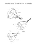 LOW PROFILE ELECTRODE ASSEMBLY diagram and image