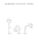 LOW PROFILE ELECTRODE ASSEMBLY diagram and image