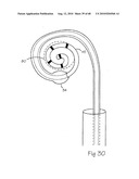 LOW PROFILE ELECTRODE ASSEMBLY diagram and image