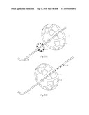 LOW PROFILE ELECTRODE ASSEMBLY diagram and image