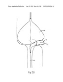 LOW PROFILE ELECTRODE ASSEMBLY diagram and image