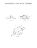 LOW PROFILE ELECTRODE ASSEMBLY diagram and image