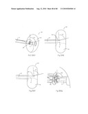 LOW PROFILE ELECTRODE ASSEMBLY diagram and image