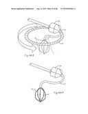 LOW PROFILE ELECTRODE ASSEMBLY diagram and image