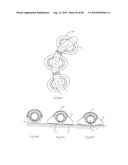 LOW PROFILE ELECTRODE ASSEMBLY diagram and image