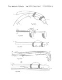 LOW PROFILE ELECTRODE ASSEMBLY diagram and image