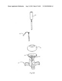 LOW PROFILE ELECTRODE ASSEMBLY diagram and image