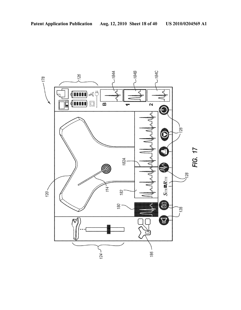 SYSTEM FOR PLACEMENT OF A CATHETER INCLUDING A SIGNAL-GENERATING STYLET - diagram, schematic, and image 19