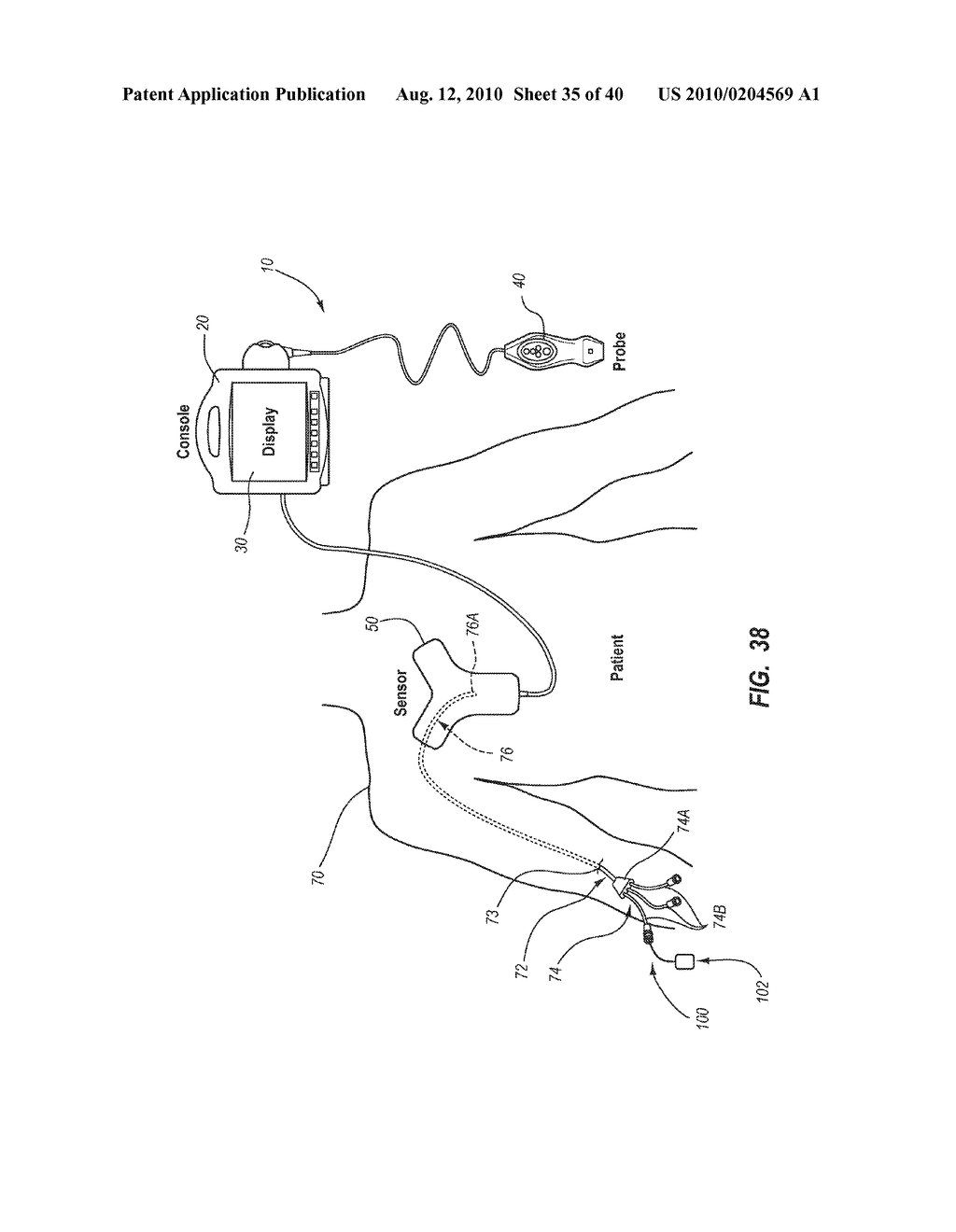 SYSTEM FOR PLACEMENT OF A CATHETER INCLUDING A SIGNAL-GENERATING STYLET - diagram, schematic, and image 36