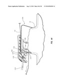 SYSTEM FOR PLACEMENT OF A CATHETER INCLUDING A SIGNAL-GENERATING STYLET diagram and image
