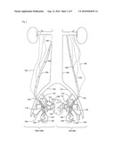 DIAGNOSIS AND TREATMENT OF VARICOCELE AND PROSTATE DISORDERS diagram and image