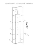 CATHETER WITH MULTIPLE ULTRASOUND RADIATING MEMBERS diagram and image