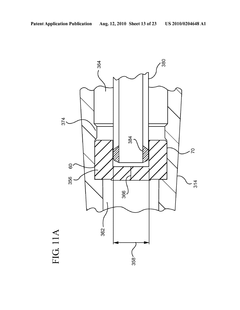 SYSTEMS AND METHODS FOR PROVIDING A FLUSHABLE CATHETER ASSEMBLY - diagram, schematic, and image 14