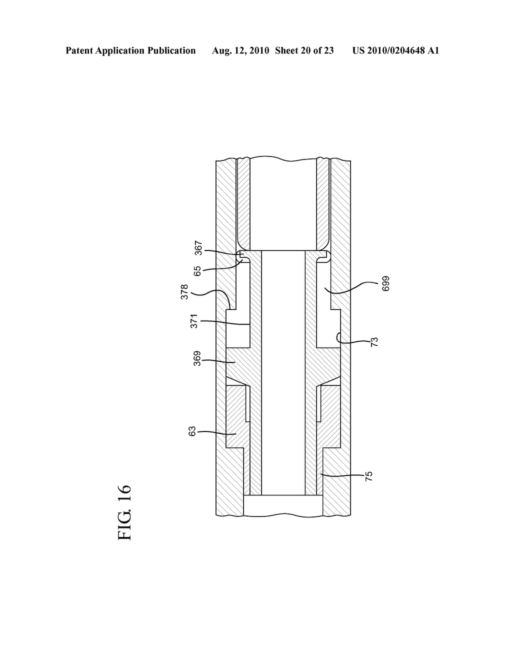 SYSTEMS AND METHODS FOR PROVIDING A FLUSHABLE CATHETER ASSEMBLY - diagram, schematic, and image 21