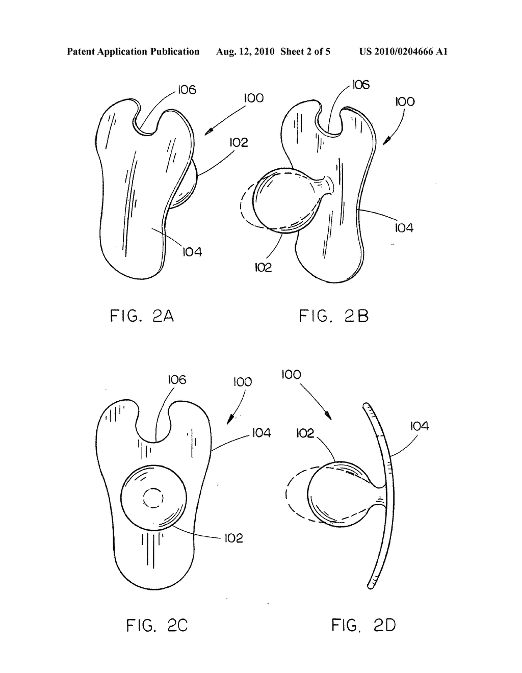 Vaginal barrier and female urethral catheterization assisting device - diagram, schematic, and image 03