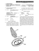 System and Method for Joint Resurface Repair diagram and image