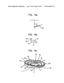 System and Method for Joint Resurface Repair diagram and image