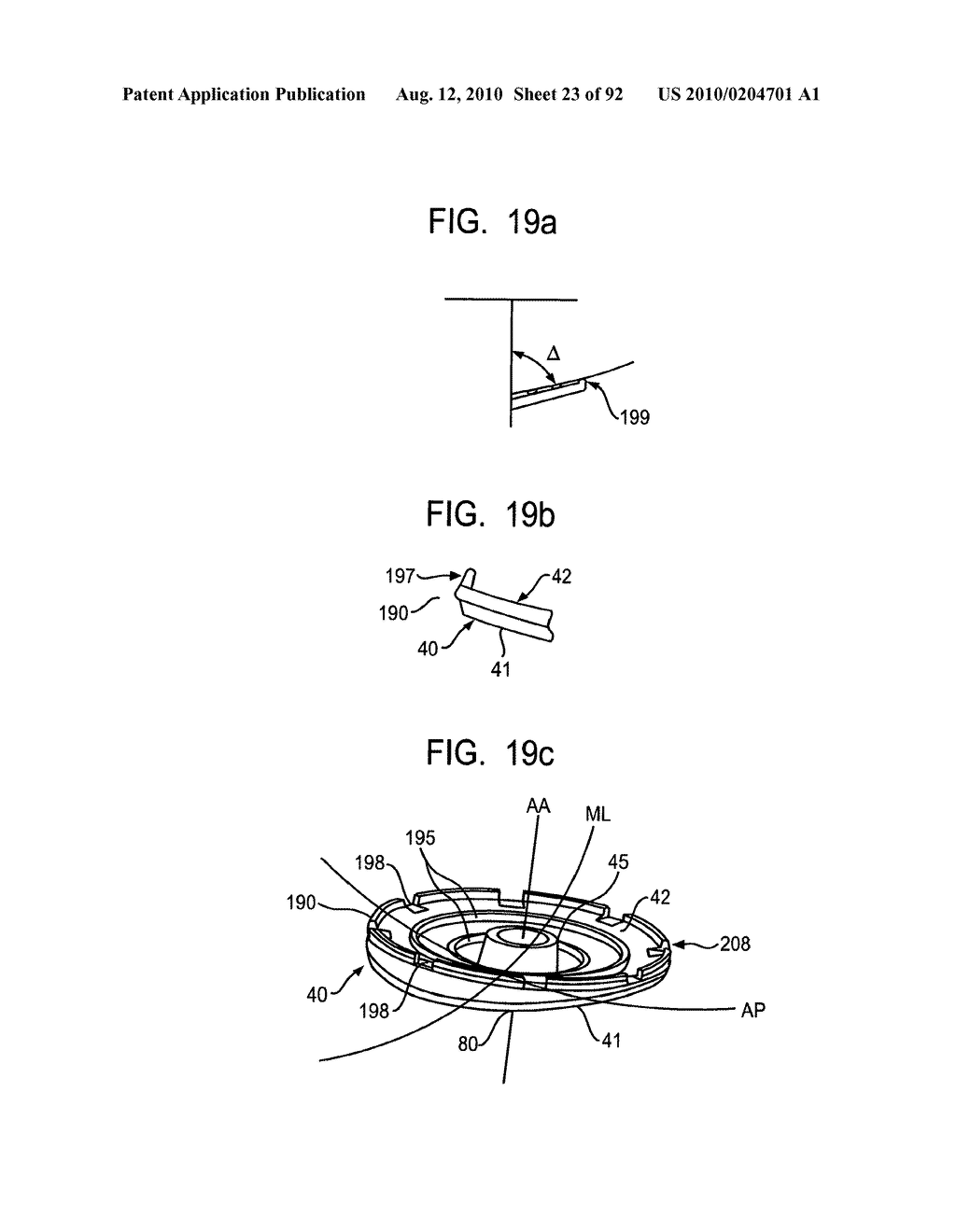 System and Method for Joint Resurface Repair - diagram, schematic, and image 24