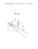 System and Method for Joint Resurface Repair diagram and image