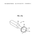 System and Method for Joint Resurface Repair diagram and image