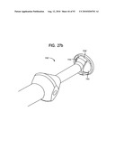 System and Method for Joint Resurface Repair diagram and image