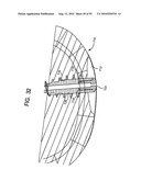 System and Method for Joint Resurface Repair diagram and image