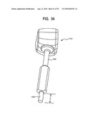 System and Method for Joint Resurface Repair diagram and image