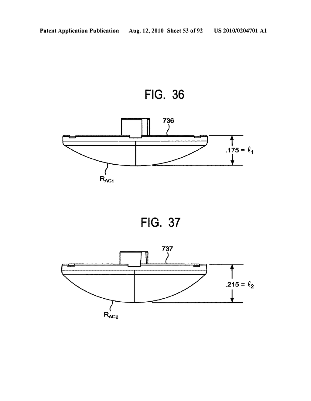 System and Method for Joint Resurface Repair - diagram, schematic, and image 54