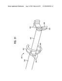 System and Method for Joint Resurface Repair diagram and image