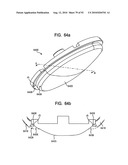 System and Method for Joint Resurface Repair diagram and image