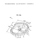 System and Method for Joint Resurface Repair diagram and image