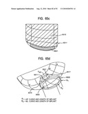 System and Method for Joint Resurface Repair diagram and image