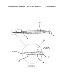 Device for Inserting an Intraocular Lens into an Eye diagram and image