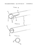 Device for Inserting an Intraocular Lens into an Eye diagram and image