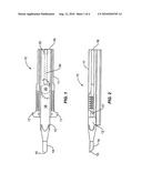 Automated Intraocular Lens Injector Device diagram and image