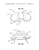SURGICAL INSTRUMENTS FOR CREATING A PNEUMOSTOMA AND TREATING CHRONIC OBSTRUCTIVE PULMONARY DISEASE diagram and image