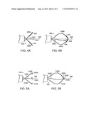 MEDICAL RETRIEVAL DEVICE diagram and image