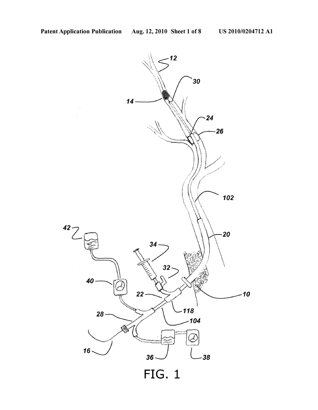 NEUROVASCULAR MICROCATHETER DEVICE, SYSTEM AND METHODS FOR USE THEREOF - diagram, schematic, and image 02