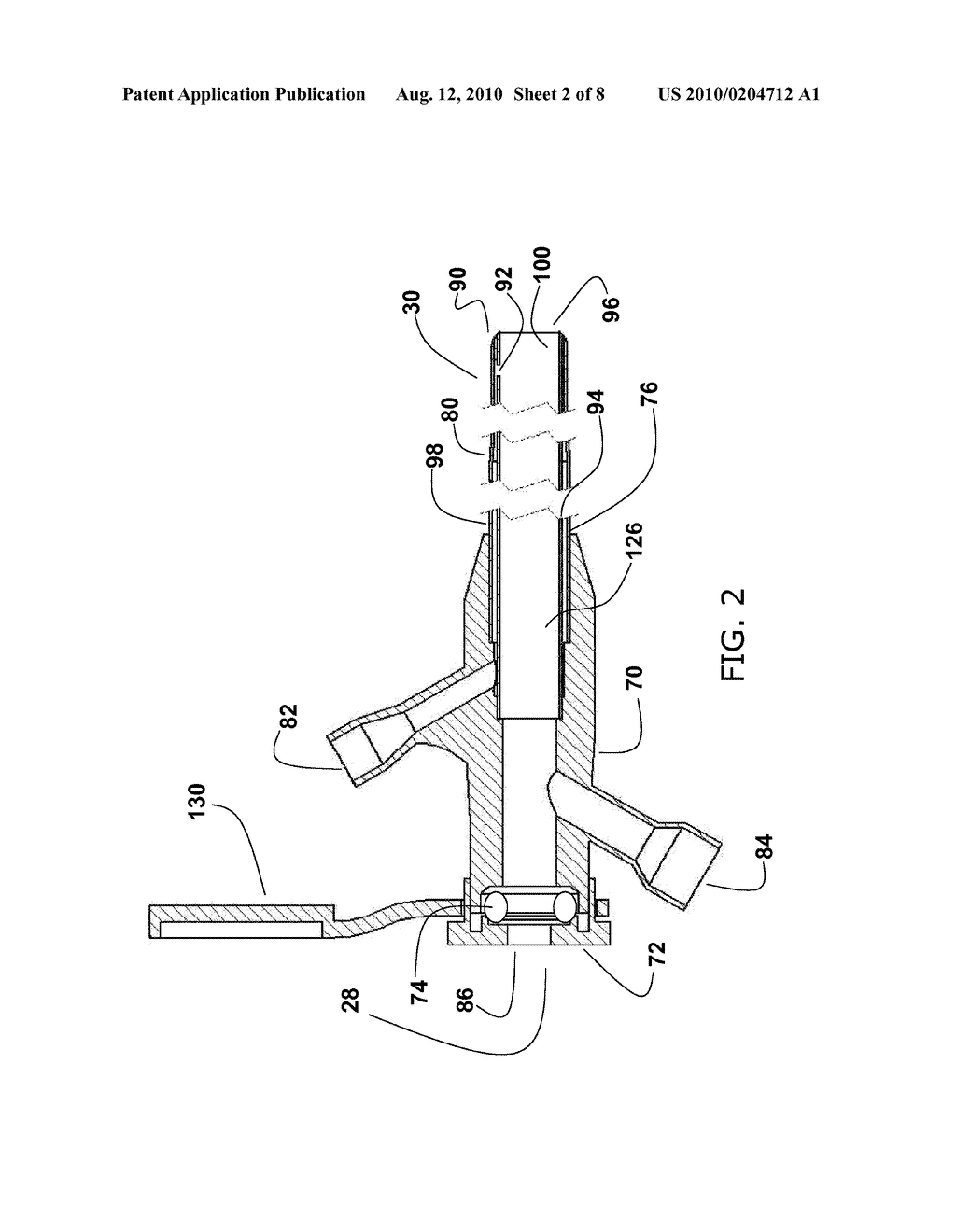 NEUROVASCULAR MICROCATHETER DEVICE, SYSTEM AND METHODS FOR USE THEREOF - diagram, schematic, and image 03