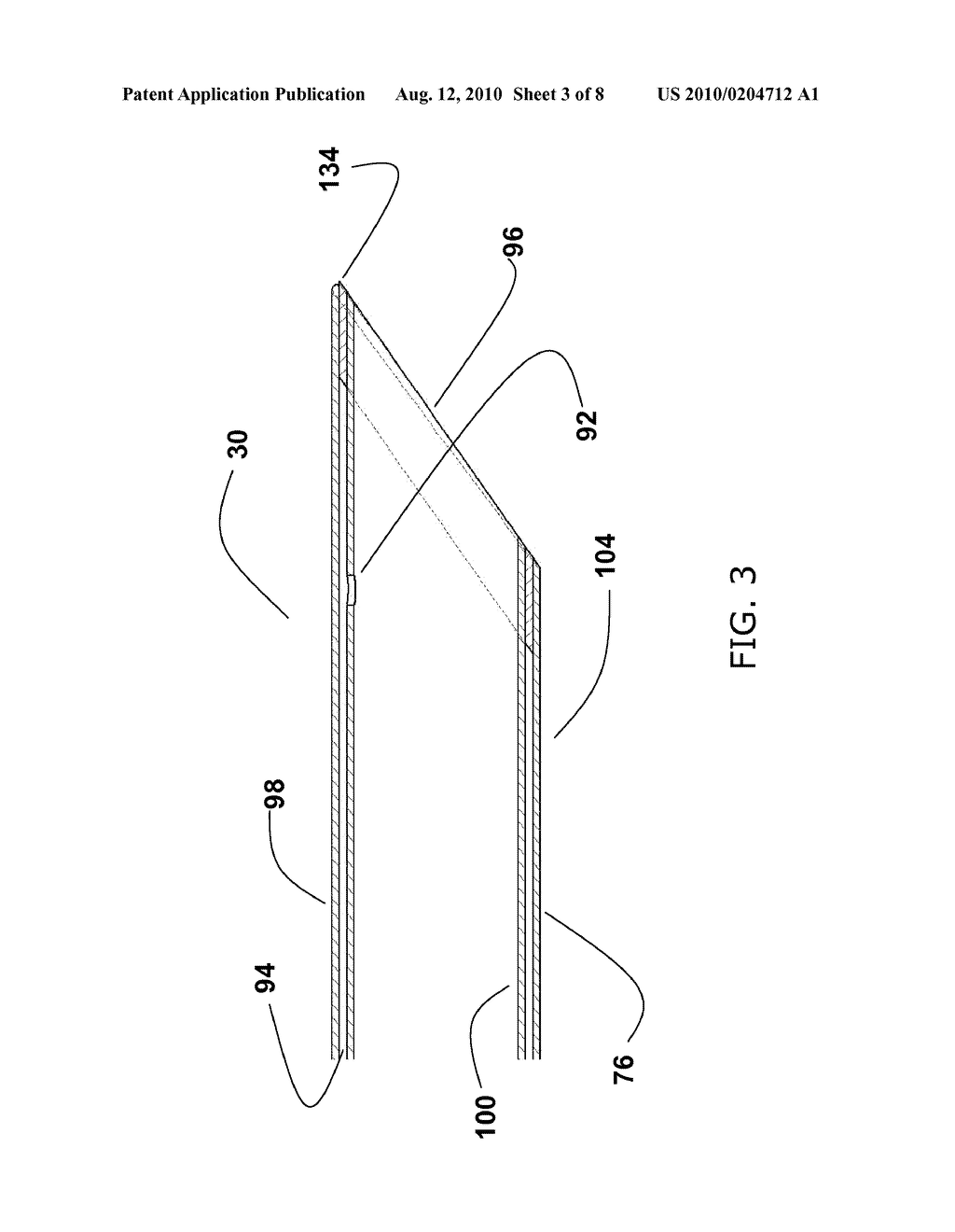 NEUROVASCULAR MICROCATHETER DEVICE, SYSTEM AND METHODS FOR USE THEREOF - diagram, schematic, and image 04