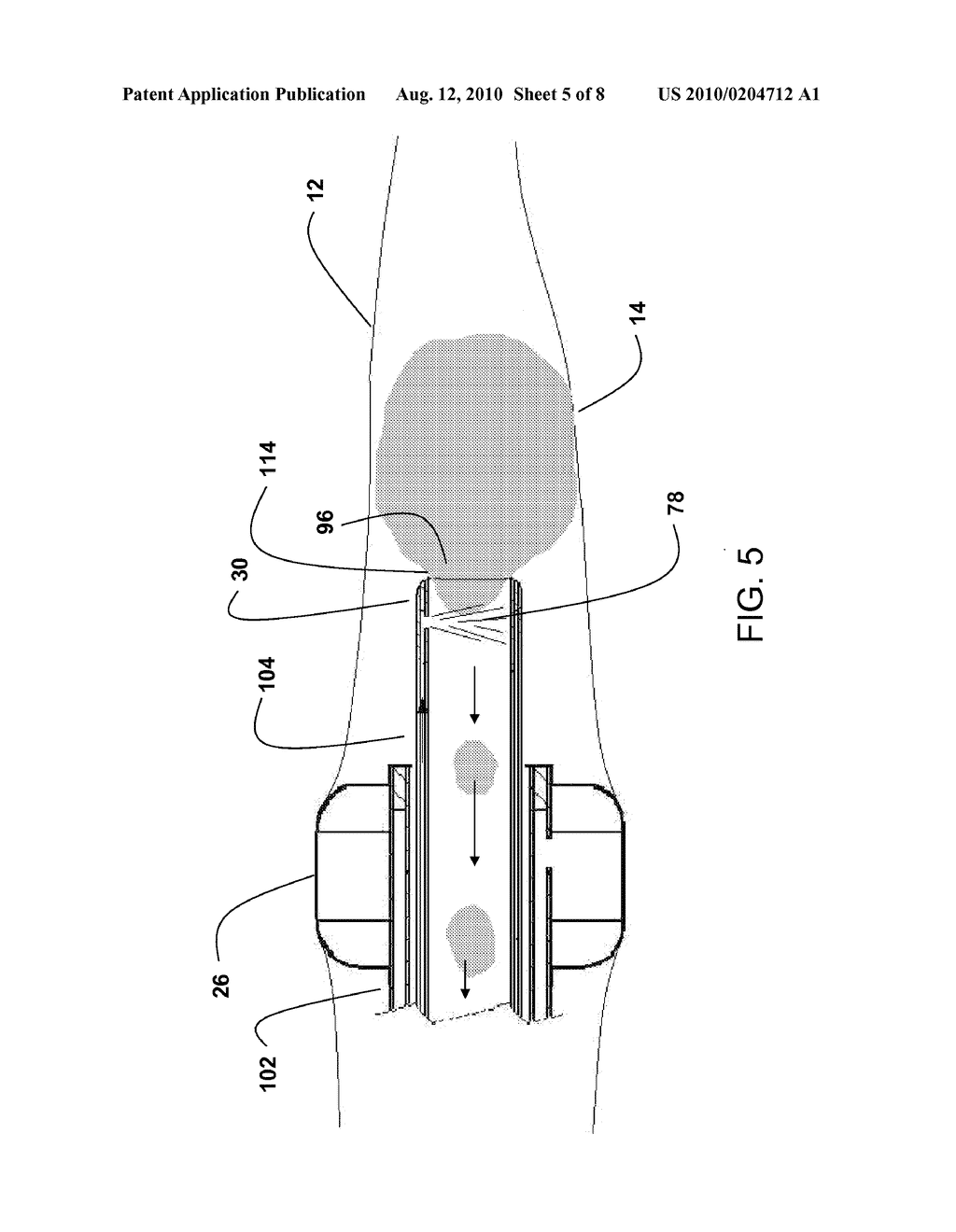 NEUROVASCULAR MICROCATHETER DEVICE, SYSTEM AND METHODS FOR USE THEREOF - diagram, schematic, and image 06