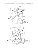 Suture Holding System diagram and image