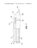 Suture Holding System diagram and image