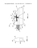 Suture Holding System diagram and image