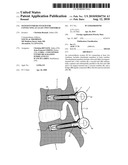 OSTEOSYNTHESIS SYSTEM FOR CONNECTING AT LEAST TWO VERTEBRAE diagram and image