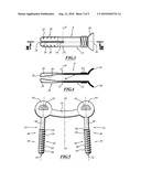 OSTEOSYNTHESIS SYSTEM FOR CONNECTING AT LEAST TWO VERTEBRAE diagram and image